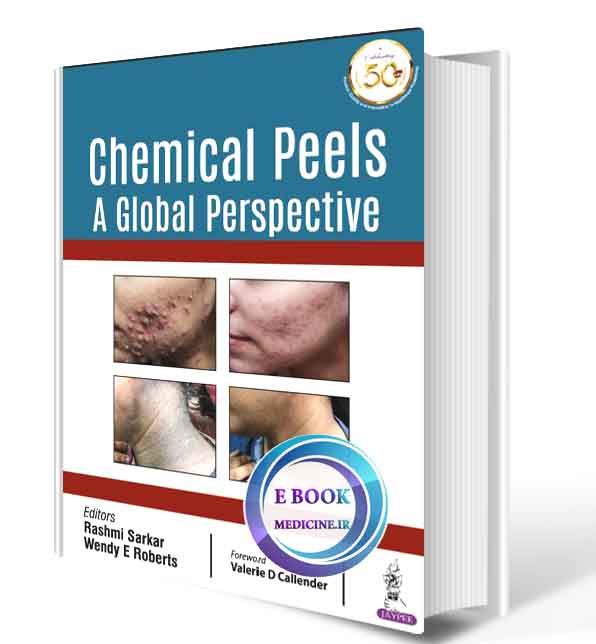 دانلود کتاب  Chemical Peels: A Global Perspective  2019 (ORIGINAL PDF)